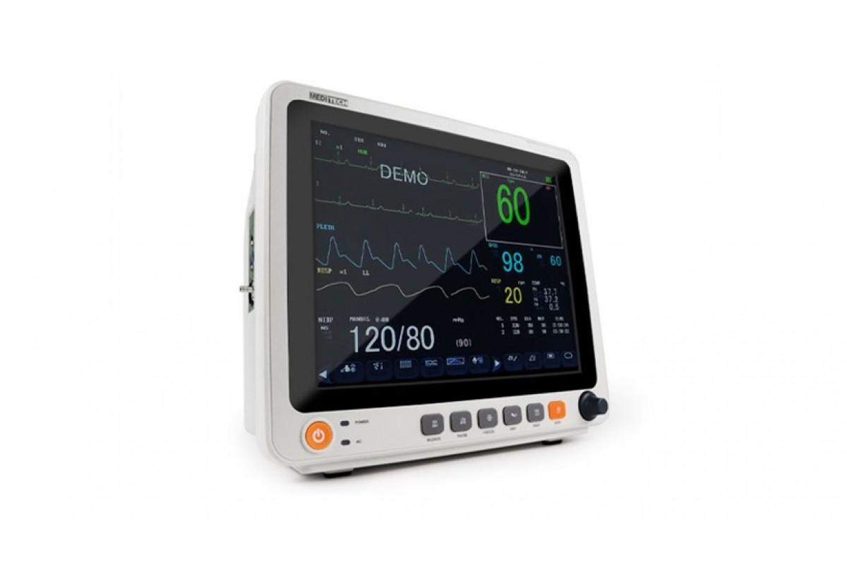 Для чого потрібен сучасний монітор пацієнта